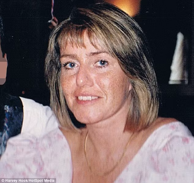 Trong ảnh là Jillian khi còn trẻ và chưa độn môi. Những tổn thương ở góc miệng khiến cô hiện không thể ăn và nói như bình thường. 