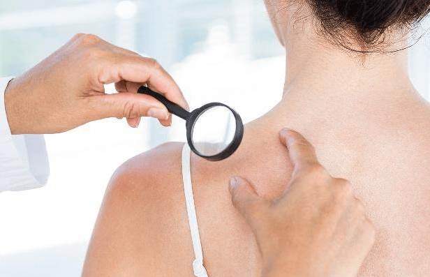 Canh giac 3 tin hieu o co la “tieng go” cua ung thu-Hinh-2