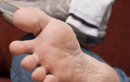 Dau hieu o chan canh bao ung thu gan it nguoi biet-Hinh-2