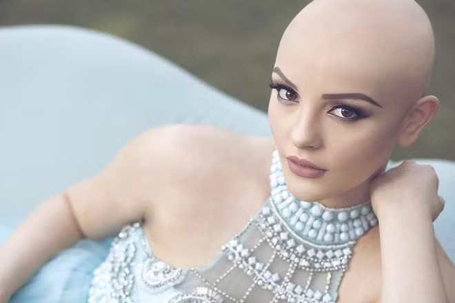 Cô gái trẻ mắc bệnh ung thư hạch hạch bạch huyết giai đoạn 2 (còn gọi là bệnh Hodgkin). Thông qua bộ ảnh, cô muốn gửi tới các bạn trẻ thông điệp: "Vẻ đẹp thực sự không nằm ở mái tóc, làn da mà trong chính tâm hồn bạn".