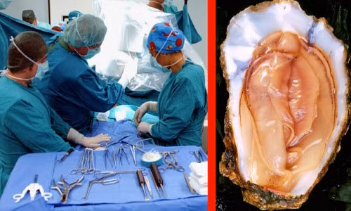 Một người đàn ông Singapore suýt làm mất “của quý” vì cố tình quan hệ thể xác với một con hàu. Câu chuyện cụ thể>>> Đòi quan hệ với hàu, người đàn ông có kết thảm