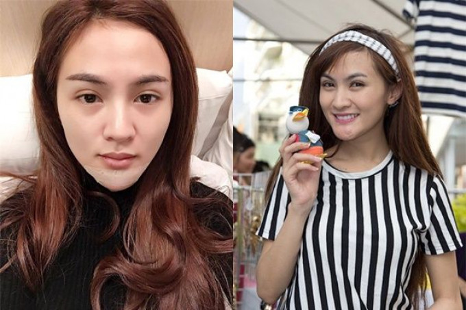 Từng có một thời gian Kelly Nguyễn hoạt động showbiz rất sôi nổi. Thế nhưng những sự cố phẫu thuật thẩm mỹ đã khiến cô trở nên dè dặt và kín tiếng hơn.