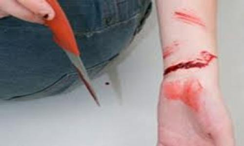 Yeu duoc 1 thang, 9X vac dao chem ban gai roi tu tu