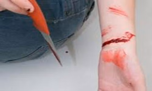 Yeu duoc 1 thang, 9X vac dao chem ban gai roi tu tu