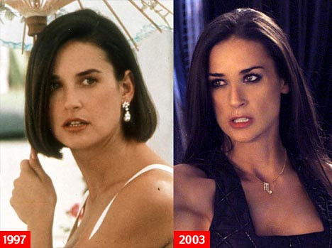 Khuôn mặt Demi Moore năm 1997 và 2003 đã có sự thay đổi rất nhiều.