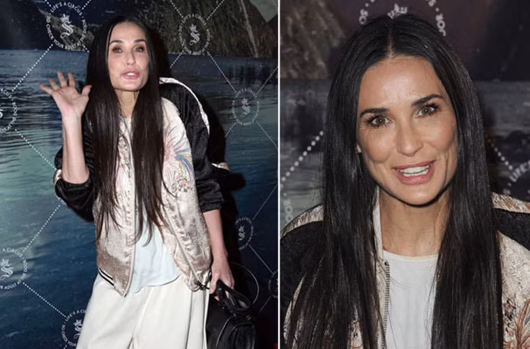 Mới đây nhất, ngôi sao "Oan hồn" đã khiến mọi người giật mình khi cô tới tham gia một sự kiện cuối tuần trước. Khuôn mặt của Demi Moore biến đổi rõ ràng. Hai gò má cao hơn bình thường và các bác sĩ phẫu thuật thẩm mỹ cho rằng cô đã bơm chất làm đầy Sculptra vào má.