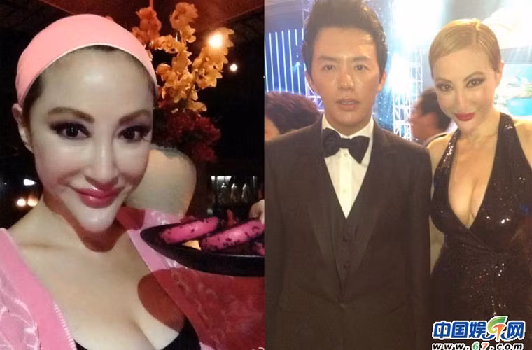 Tiết Chỉ Luân bị gọi là “thảm họa thẩm mỹ” bởi cô đã phá hỏng khuôn mặt đẹp của mình bằng những lần dao kéo.