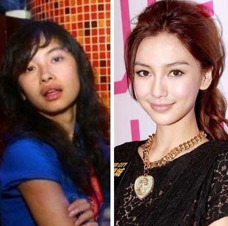 Nhờ thay đổi hoàn toàn khuôn mặt, từ cô gái có hàm răng hơi hô, khuôn mặt tròn, cô người mẫu kiêm diễn viên Hong Kong xinh đẹp gấp bội phần với khuôn mặt V-line thanh tú, sóng mũi cao gọn gàng, cằm nhọn, hàm răng đều tăm tắp.