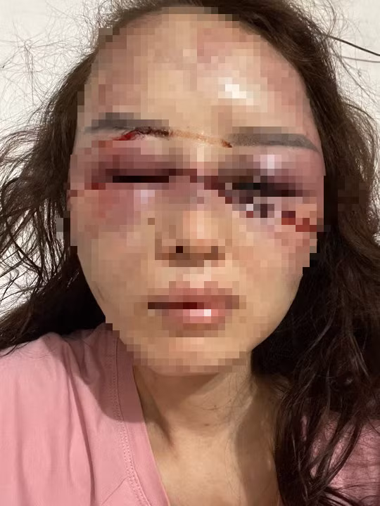 Can bo QLTT Thanh Hoa bi to hanh hung: Co dau hieu toi pham!-Hinh-2