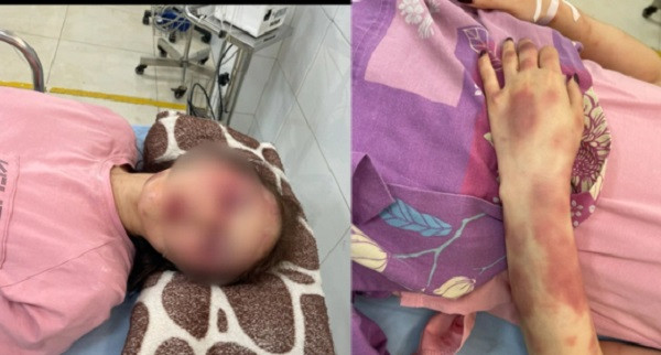 Can bo QLTT Thanh Hoa bi to hanh hung: Co dau hieu toi pham!