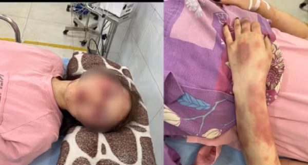 Can bo QLTT Thanh Hoa bi to hanh hung: Co dau hieu toi pham!