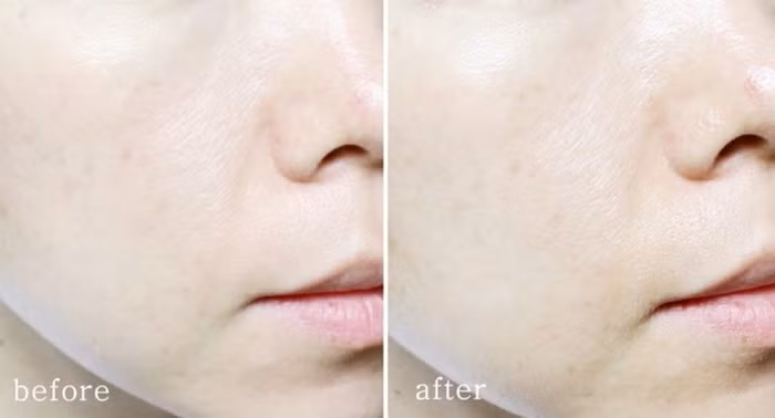 Khi thoa lên da, nó tự biến thành những hạt li ti bám lên bề mặt da, để lại một làn da căng mọng, lấp lánh và rạng rỡ. Dòng kem này không thấm nước hay đổ mồ hôi, kết cấu không quá đặc, không gây nhờn rít, bí da, tạo cảm giác nhẹ nhàng, khô ráo mùi hương dễ chịu, thấm nhanh, không gây hiệu ứng trắng mặt. Ảnh: Upshop.