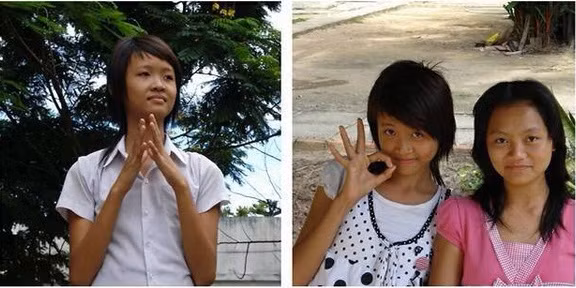 Trương Mỹ Nhân cũng là một cái tên rất nổi của cuộc thi The Face 2017. Cô gái với vẻ đẹp trong trẻo hiền lành dễ gây thiện cảm với người đối diện. Thế nhưng nhan sắc xinh đẹp như ngọc nữ của Trương Mỹ Nhân không phải tự nhiên mà có. Cô từng vướng rất nhiều nghi vấn thẩm mỹ xoay quanh nhan sắc của mình. Ảnh: Megafun.