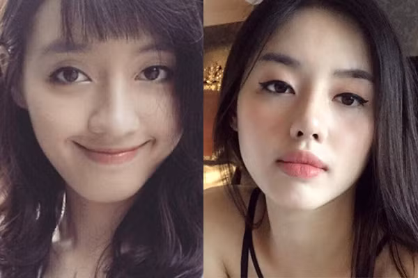 Thay vì im lặng thì "bản sao của Tâm Tít" đã lên tiếng thừa nhận mình đã phẫu thuật thẩm mỹ. Cô cho biết, chính ba cô là một bác sĩ thẩm mỹ đã phẫu thuật cho mình. Ảnh: FB Khánh Linh.