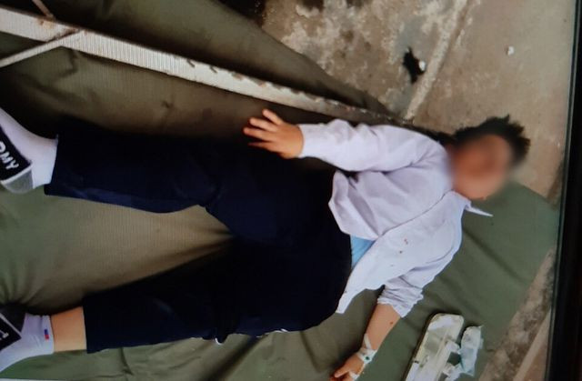 Hai Duong: Gio the duc, hoc sinh lop 6 bi sao nhay cao do vao dau nguy kich