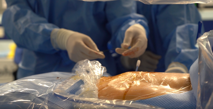 Tan soi duong mat qua da bang laser – buoc tien thay the phuong phap mo mo-Hinh-4