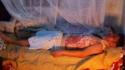 Nghe An: Mau thuan, vo tuoi nuoc soi len nguoi chong