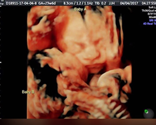 Chong dua vo di sieu am thi khong tin noi vao hinh anh minh nhin thay-Hinh-2