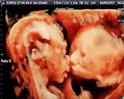 Chong dua vo di sieu am thi khong tin noi vao hinh anh minh nhin thay