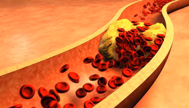 Neu 3 cho tren co the luon “CUNG” co nghia rang tuoi tho ngan-Hinh-4