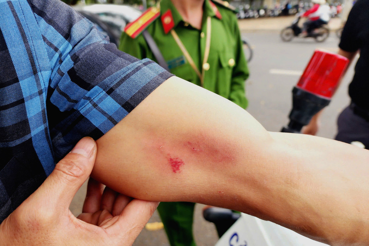 Tác nghiệp tại công trình bỏ hoang, PV Báo CAND tố bị hành hung Tac nghiep tai cong trinh bo hoang, PV Bao CAND to bi hanh hung