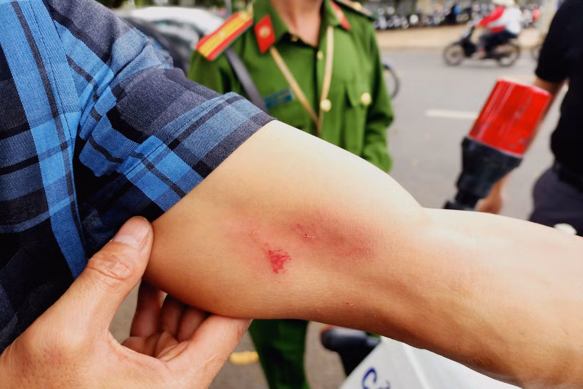 Tác nghiệp tại công trình bỏ hoang, PV Báo CAND tố bị hành hung Tac nghiep tai cong trinh bo hoang, PV Bao CAND to bi hanh hung