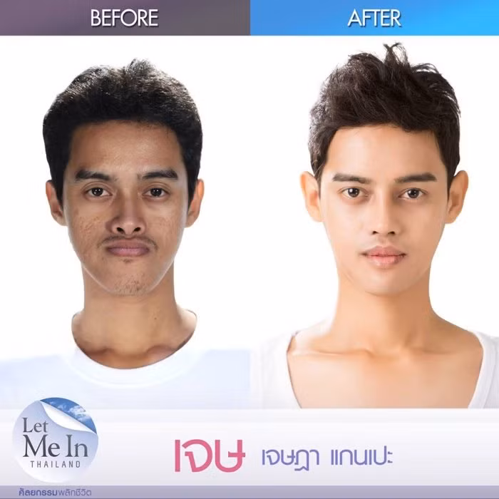 Từ khi còn nhỏ, Jay đã rất buồn vì ngoại hình của mình với làn da tái, rỗ, hàm đưa ra phía trước cả chục mm.