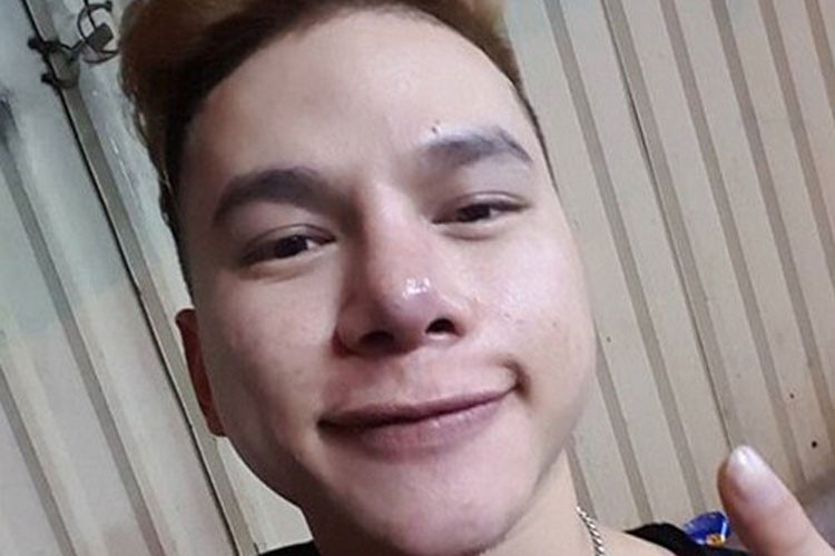 Năm 2016, Hoàng Tôn bất ngờ cầu cứu cư dân mạng trước việc gương mặt bị biến dạng khi chiếc mũi bị sưng, không thon, cằm dài và cộm. Ảnh: FBNV