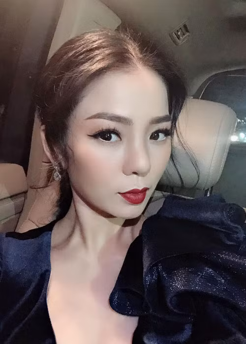 Hình ảnh mũi của Lệ Quyên sau khi tháo bỏ sụn. Trước Lệ Quyên, nhiều sao Việt cũng gặp họa vì biến chứng sau khi phẫu thuật nâng mũi. Ảnh: FBNV