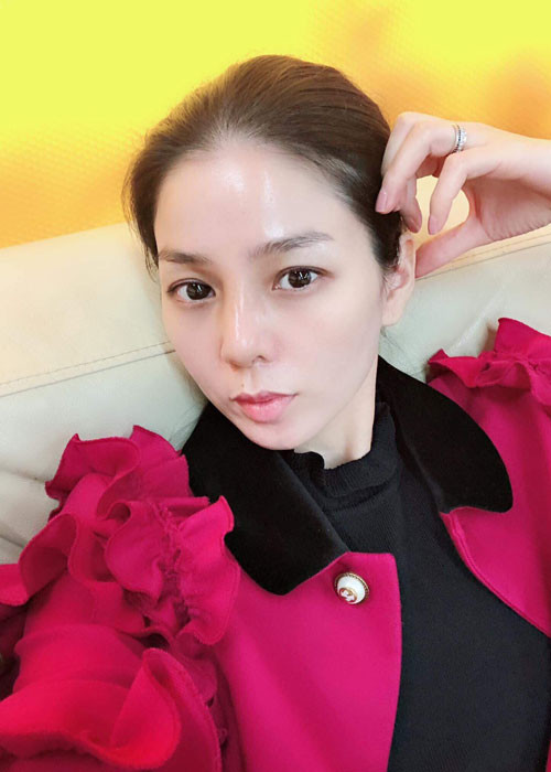 Nhiều năm trước, Lệ Quyên nâng mũi. Gần đây, mũi của nữ ca sĩ bị sưng nặng do cơ thể tự đào thải sụn cũ buộc cô phải phẫu thuật tháo bỏ sụn mũi. Ảnh: FBNV