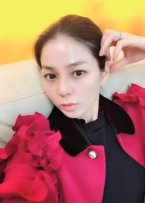 Nhiều năm trước, Lệ Quyên nâng mũi. Gần đây, mũi của nữ ca sĩ bị sưng nặng do cơ thể tự đào thải sụn cũ buộc cô phải phẫu thuật tháo bỏ sụn mũi. Ảnh: FBNV