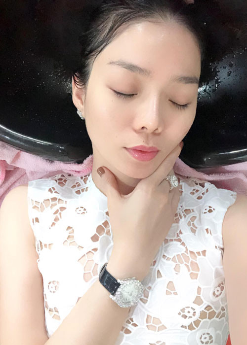 Hình ảnh mũi của Lệ Quyên khi chưa bị biến chứng.