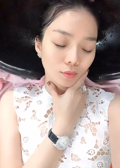 Hình ảnh mũi của Lệ Quyên khi chưa bị biến chứng.