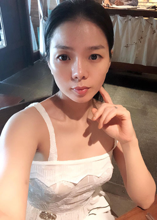 Gần đây, Lệ Quyên bất ngờ gặp biến chứng sau nhiều năm nâng mũi. Để tránh mũi bị hoại tử, cô đã tháo sụn mũi.