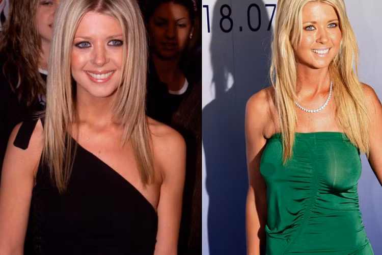 Năm 2004, nữ diễn viên Tara Reid dao kéo để khắc phục vòng 1 không cân đối. Định tăng lên kích cỡ cúp B, cô phát hiện bị nhầm nâng lên cỡ lớn hơn là C.