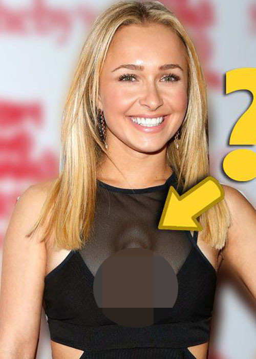 Ca sĩ người Mỹ Hayden Panettiere cũng bị biến dạng ngực với vết lõm đáng sợ sau phẫu thuật. Ảnh: Pinterest