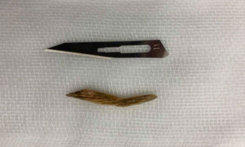 Xuong ca dam thung hau mon-Hinh-2