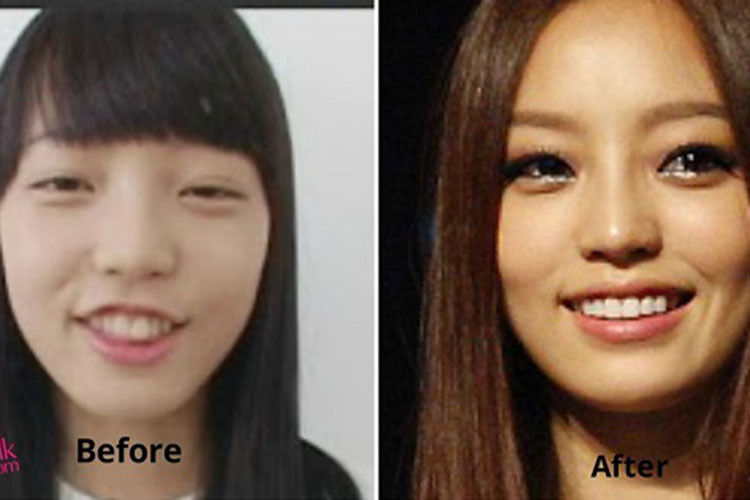 Nữ ca sĩ sinh năm 1991 đã chỉnh sửa nhiều đường nét trên gương mặt từ mắt, mũi, miệng đến cằm.