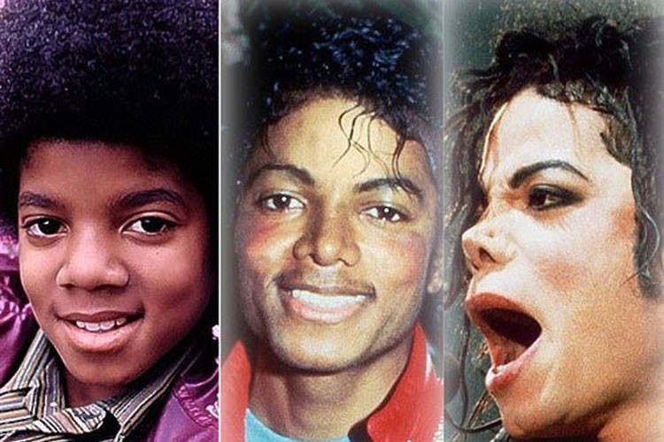 Nhìn ra thế giới, không ít sao ngoại cũng gặp họa vì biến chứng hậu dao kéo mũi. Michael Jackson là một trong số đó. Ảnh: Dân Việt