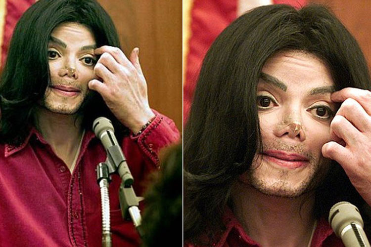 Michael Jackson nghiện dao kéo đến mức sửa mũi đến 4-5 lần. Để che kết quả phẫu thuật nâng mũi hỏng, anh phải đeo đầu mũi giả. Ảnh: VTC