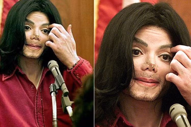 Michael Jackson nghiện dao kéo đến mức sửa mũi đến 4-5 lần. Để che kết quả phẫu thuật nâng mũi hỏng, anh phải đeo đầu mũi giả. Ảnh: VTC