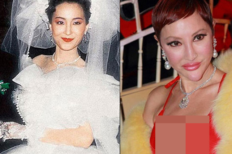 Từ xinh đẹp, Tiết Chỉ Luân cũng trở thành thảm họa phẫu thuật thẩm mỹ. Sống mũi của cô nhô ra bất thường, cằm dài khiến gương mặt trở nên xấu xí. Ảnh: Khám phá