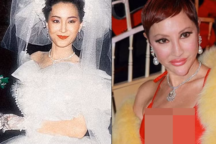 Từ xinh đẹp, Tiết Chỉ Luân cũng trở thành thảm họa phẫu thuật thẩm mỹ. Sống mũi của cô nhô ra bất thường, cằm dài khiến gương mặt trở nên xấu xí. Ảnh: Khám phá