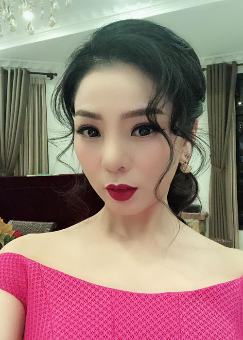 Việc Lệ Quyên nâng mũi được công khai từ lâu. Gần đây, mũi của cô bị sưng nặng, nguy cơ hoại tử nên Lệ Quyên buộc phải phẫu thuật tháo bỏ sụn mũi. Ảnh: FBNV