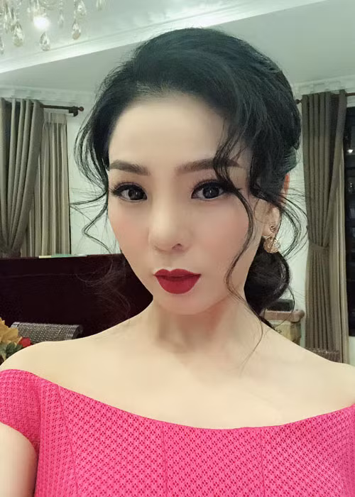 Việc Lệ Quyên nâng mũi được công khai từ lâu. Gần đây, mũi của cô bị sưng nặng, nguy cơ hoại tử nên Lệ Quyên buộc phải phẫu thuật tháo bỏ sụn mũi. Ảnh: FBNV