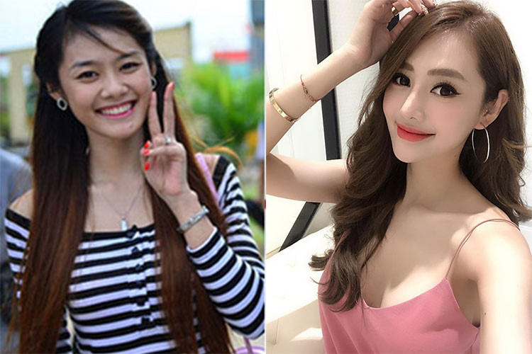 Nữ người mẫu Linh Chi thừa nhận tu sửa vòng một vào năm 2014. Lý do của cô là chủ yếu vì công việc. Ảnh: Dân Việt