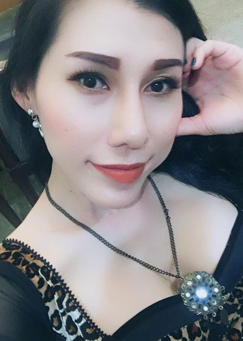 Trước khi gặp biến chứng, Ivy Trần đã lột xác nhờ dao kéo vòng 1. Không chỉ nữ ca sĩ Ivy Trần, nhiều mỹ nhân Việt cũng lên đời nhờ nâng ngực.