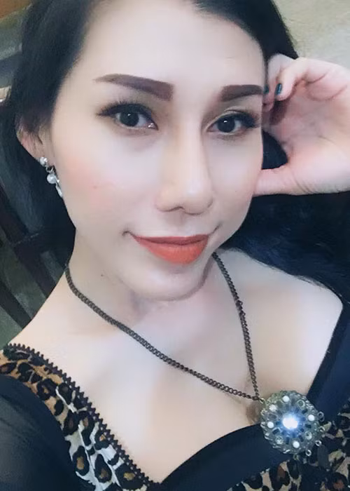 Trước khi gặp biến chứng, Ivy Trần đã lột xác nhờ dao kéo vòng 1. Không chỉ nữ ca sĩ Ivy Trần, nhiều mỹ nhân Việt cũng lên đời nhờ nâng ngực.