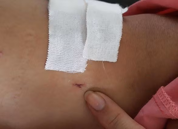 Vu khoan nham cang chan benh nhan: Do nhan lam... nguoi benh