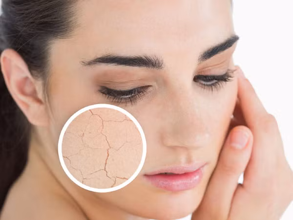 Da khô. Những người có loại da khô rất kị sữa rửa mặt có chất hóa học vì chúng có xu hướng làm khô da bạn. Hãy thử rửa mặt bằng những loại tự nhiên để cân bằng độ ẩm tự nhiên cho da mặt xem, kết quả hẳn sẽ làm bạn ngạc nhiên.